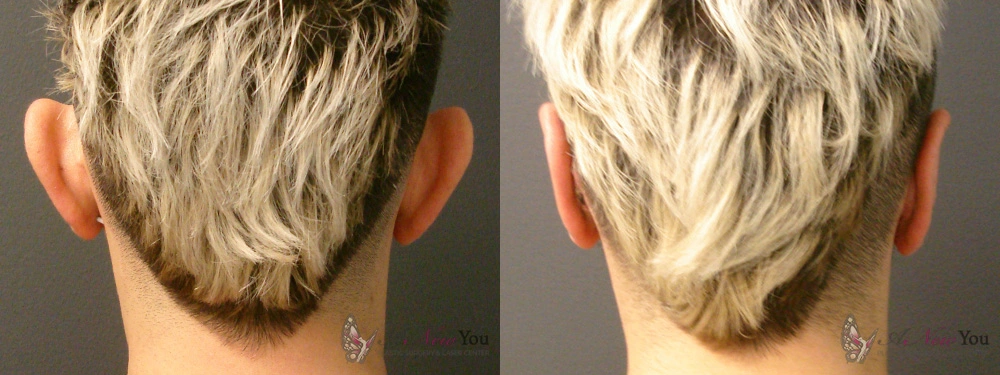 Real Patient Results by Dr. Shah of A New You Plastic Surgery & Medical Spa in Chicago, IL