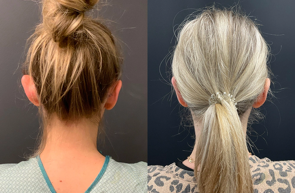 Real Patient Results by Dr. Shah of A New You Plastic Surgery & Medical Spa in Chicago, IL