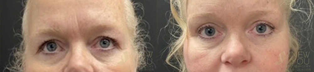 Real Patient Results by Dr. Shah of A New You Plastic Surgery & Medical Spa in Chicago, IL